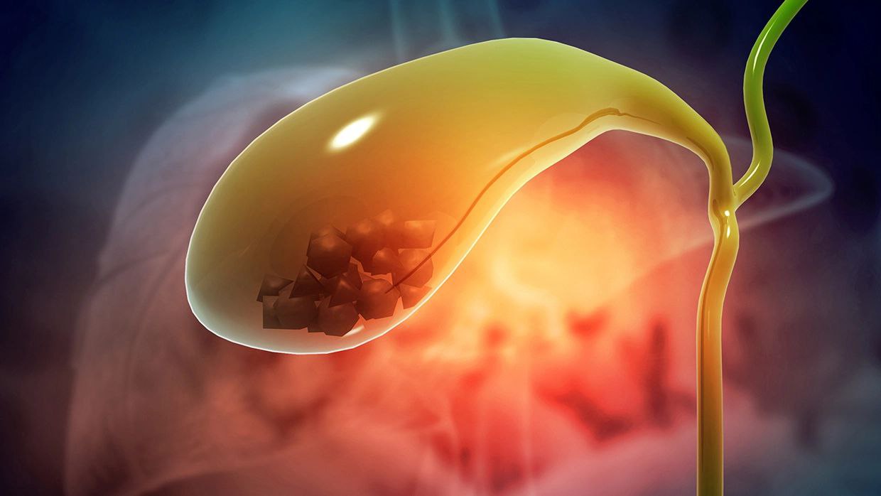 Ўт Қопи Димланиши